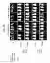 Fig. 11 - Compositions and methods for treating ewing sarcoma