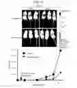 Fig. 12 - Compositions and methods for treating ewing sarcoma