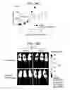 Fig. 16 - Compositions and methods for treating ewing sarcoma