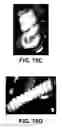 Fig. 17 - Shape changing drug delivery devices and methods