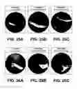 Fig. 23 - Shape changing drug delivery devices and methods