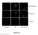 Fig. 05 - Method for regulating retinal endothelial cell viability