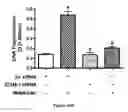 Fig. 45 - Method for regulating retinal endothelial cell viability
