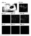 Fig. 02 - METHODS AND COMPOSITIONS FOR TREATING PAIN