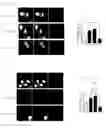 Fig. 13 - Pharmaceutical composition for preventing or treating neurodegenerative diseases