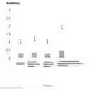 Fig. 02 - Treatment of Motor Neuronopathies
