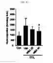 Fig. 06 - Pharmaceutical composition for preventing or treating of cirrhosis of liver comprising G protein coupled receptor 119 ligand as an active ingredient