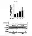 Fig. 08 - Pharmaceutical composition for preventing or treating of cirrhosis of liver comprising G protein coupled receptor 119 ligand as an active ingredient