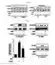 Fig. 10 - Pharmaceutical composition for preventing or treating of cirrhosis of liver comprising G protein coupled receptor 119 ligand as an active ingredient