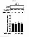 Fig. 13 - Pharmaceutical composition for preventing or treating of cirrhosis of liver comprising G protein coupled receptor 119 ligand as an active ingredient