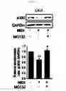 Fig. 14 - Pharmaceutical composition for preventing or treating of cirrhosis of liver comprising G protein coupled receptor 119 ligand as an active ingredient