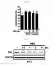 Fig. 15 - Pharmaceutical composition for preventing or treating of cirrhosis of liver comprising G protein coupled receptor 119 ligand as an active ingredient