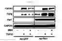 Fig. 16 - Pharmaceutical composition for preventing or treating of cirrhosis of liver comprising G protein coupled receptor 119 ligand as an active ingredient
