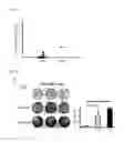 Fig. 19 - Dendritic cell immune receptor activator, method for activating dendritic cell immune receptor, osteoclast formation inhibitor, method for inhibiting osteoclast formation, dendritic cell differentiation/proliferation inhibitor, method for inhibiting dendritic cell differentiation/proliferation, cytokine production inhibitor, method for inhibiting cytokine production, therapeutic method and screening method