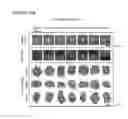 Fig. 28 - STEM CELL SUBPOPULATIONS WITH DIFFERENTIAL GSTT1 EXPRESSION OR GENOTYPE