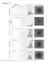 Fig. 34 - STEM CELL SUBPOPULATIONS WITH DIFFERENTIAL GSTT1 EXPRESSION OR GENOTYPE