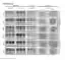 Fig. 35 - STEM CELL SUBPOPULATIONS WITH DIFFERENTIAL GSTT1 EXPRESSION OR GENOTYPE