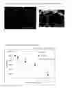 Fig. 02 - Composition comprising cell and biocompatible polymer