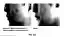 Fig. 12 - COMPOSITION CONTAINING PSEUDOMONAS AERUGINOSA CULTURE SOLUTION EXTRACT HAVING ANTIBIOTIC AND ANTISEPTIC ACTIVITIES, AND USE THEREOF
