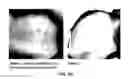 Fig. 13 - COMPOSITION CONTAINING PSEUDOMONAS AERUGINOSA CULTURE SOLUTION EXTRACT HAVING ANTIBIOTIC AND ANTISEPTIC ACTIVITIES, AND USE THEREOF