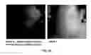 Fig. 14 - COMPOSITION CONTAINING PSEUDOMONAS AERUGINOSA CULTURE SOLUTION EXTRACT HAVING ANTIBIOTIC AND ANTISEPTIC ACTIVITIES, AND USE THEREOF