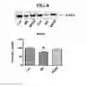 Fig. 11 - MITOCHONDRIAL-TARGETED ANTIOXIDANTS PROTECT AGAINST MECHANICAL VENTILATION-INDUCED DIAPHRAGM DYSFUNCTION AND SKELETAL MUSCLE ATROPHY