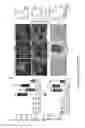 Fig. 13 - Modulation of cellular stress using a B-cell oxidative and/or endoplasmic reticulum stress inhibitor and a targeting agent