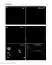 Fig. 08 - Treatment or prevention of melanoma using photochemical internalization of a melanoma antigen