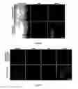 Fig. 97 - Library of pH responsive polymers and nanoprobes thereof