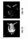 Fig. 08 - MRI signal suppression agents, compositions, and methods
