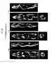 Fig. 07 - Method for labeling exosomes with radioactive substance and use thereof