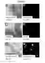 Fig. 27 - Coated surgical mesh, and corresponding systems and methods
