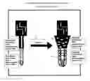 Fig. 35 - Coated surgical mesh, and corresponding systems and methods