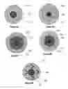 Fig. 49 - Coated surgical mesh, and corresponding systems and methods
