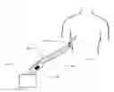 Fig. 01 - Devices and methods for managing chest drainage