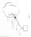 Fig. 02 - Devices and methods for managing chest drainage