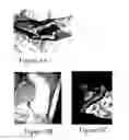 Fig. 09 - Wound healing device