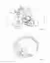 Fig. 05 - Devices, systems, and methods for facilitating flow from the heart to a blood pump