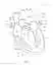 Fig. 03 - SYSTEMS AND METHODS FOR PRESSURE-REGULATED VOLUME CONTROL DURING CARDIOPULMONARY BYPASS AND PERFUSION PROCEDURES