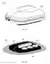Fig. 03 - Wearable medication delivery device