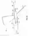 Fig. 15 - Passively shielding needle assembly with skin sensor