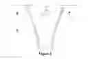Fig. 05 - AEROSOLISATION ENGINE FOR LIQUID DRUG DELIVERY BACKGROUND