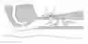 Fig. 01 - CUFF AND TRACHEAL TUBE