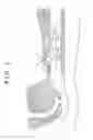 Fig. 02 - CUFF AND TRACHEAL TUBE