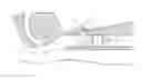 Fig. 01 - TRACHEAL TUBE