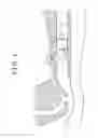 Fig. 02 - TRACHEAL TUBE