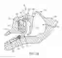 Fig. 03 - DEVICE FOR SURFACTANT ADMINISTRATION AND VENTILATION OF LOW BIRTH WEIGHT INFANTS