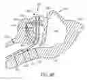 Fig. 09 - DEVICE FOR SURFACTANT ADMINISTRATION AND VENTILATION OF LOW BIRTH WEIGHT INFANTS