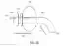 Fig. 11 - DEVICE FOR SURFACTANT ADMINISTRATION AND VENTILATION OF LOW BIRTH WEIGHT INFANTS