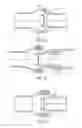Fig. 16 - Respiratory mask system with vent assembly